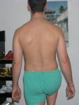 posturometrie